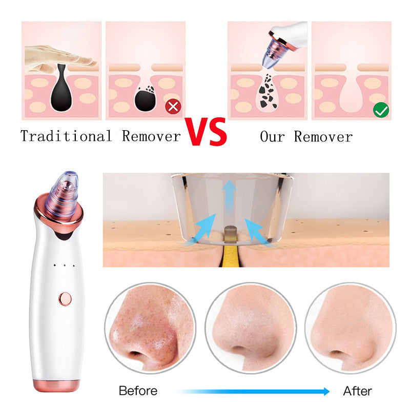 Blackhead removedor de vácuo elétrico nariz beleza rosto limpeza profunda cuidados com a pele manchas preto acne poros cleaner espinha ferramenta - coffeewithmee1